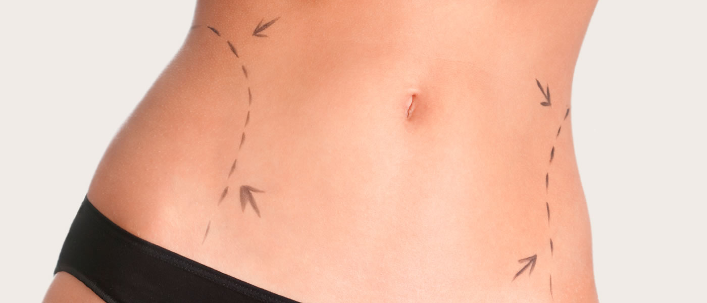 Everything You Need To Know About Cool Sculpting Procedure