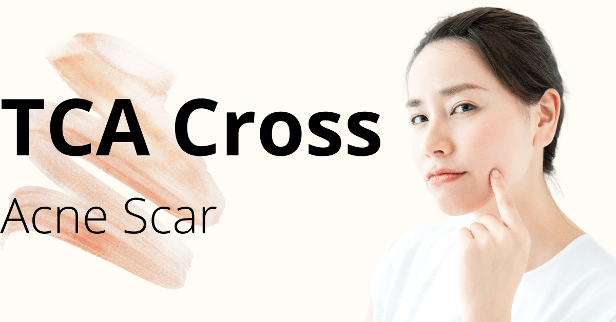 Factors to Consider when Choosing the Best online site for your Medical Skincare Clinic